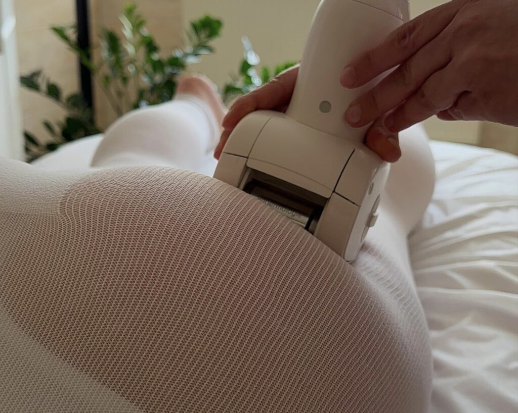 Endermologia LPG Alliance – zdjęcie 2