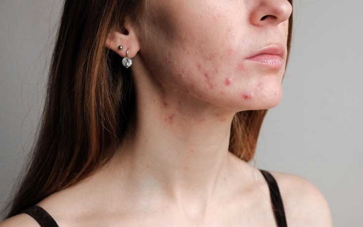Dermatologia – zdjęcie 3