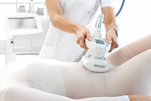 Endermologia LPG Alliance – zdjęcie 5