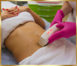 Terapia Hifu – Derkomed Tarnowskie Góry