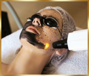 Peeling węglowy – Derkomed Tarnowskie Góry