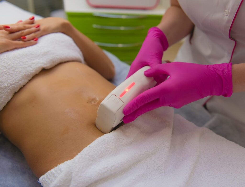Terapia HIFU – zdjęcie 1