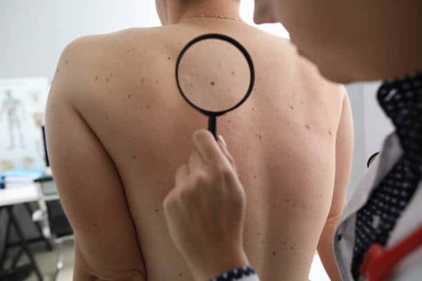Diagnostyka dermatologiczna – zdjęcie 1