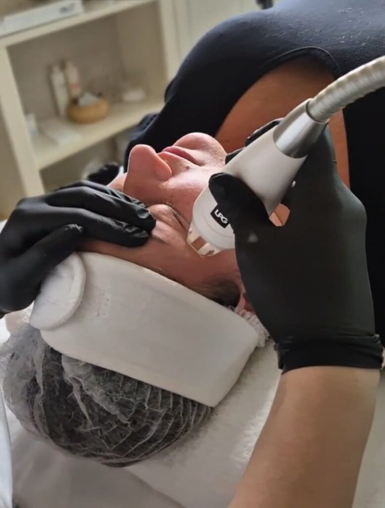 Endermologia twarzy – zdjęcie 1