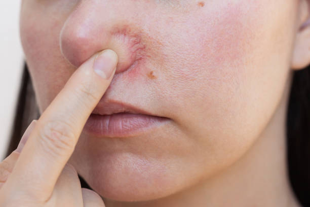 Dermatologia – zdjęcie 2