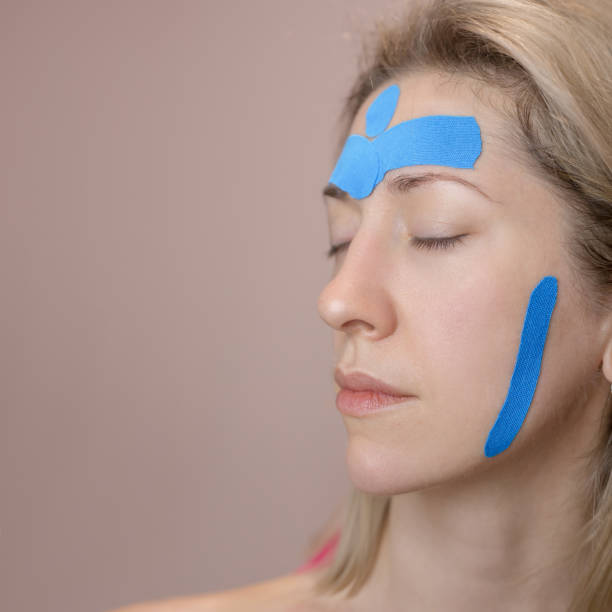 Kinesiotaping twarzy – zdjęcie 2