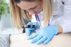 Konsultacje dermatologiczne – zdjęcie 1